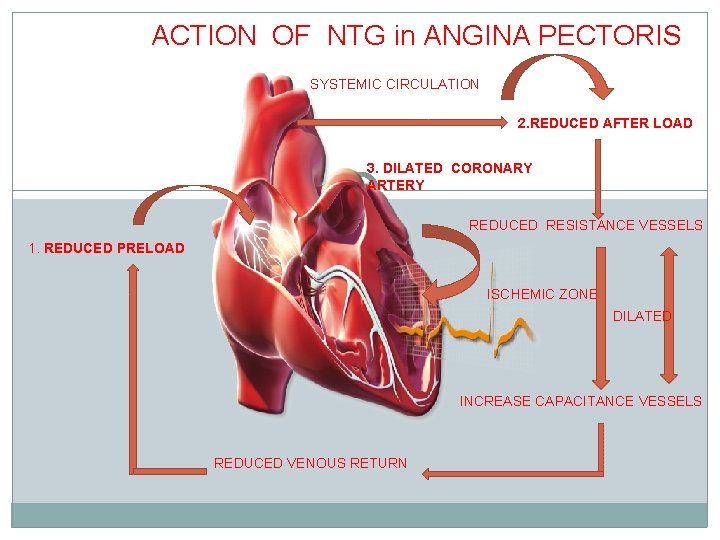 ACTION OF NTG in ANGINA PECTORIS SYSTEMIC CIRCULATION 2. REDUCED AFTER LOAD 3. DILATED