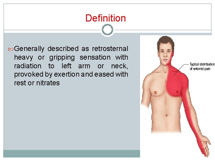 Definition Generally described as retrosternal heavy or gripping sensation with radiation to left arm