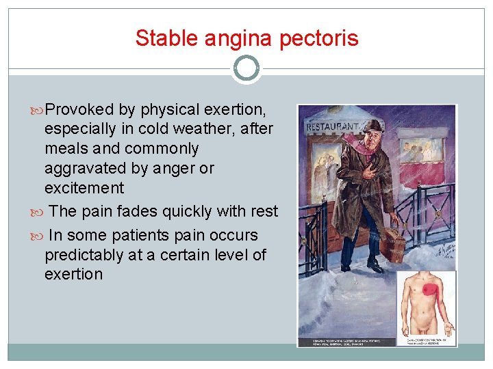 Stable angina pectoris Provoked by physical exertion, especially in cold weather, after meals and
