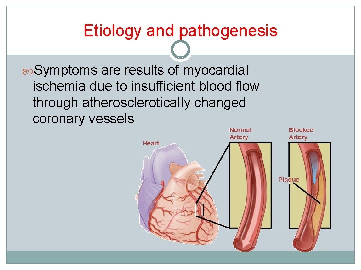 Etiology and pathogenesis Symptoms are results of myocardial ischemia due to insufficient blood flow