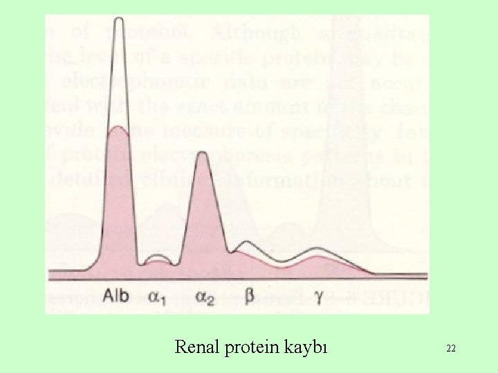 Renal protein kaybı 22 