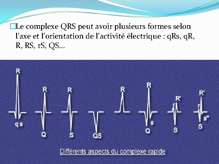 �Le complexe QRS peut avoir plusieurs formes selon l’axe et l’orientation de l’activité électrique