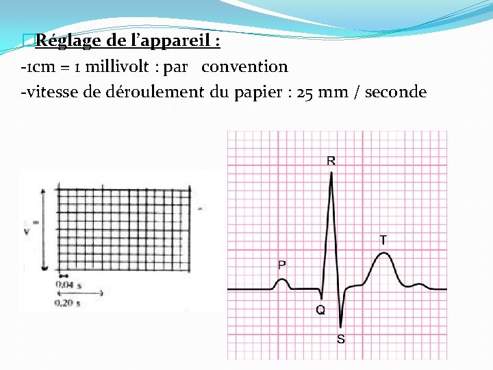 �Réglage de l’appareil : -1 cm = 1 millivolt : par convention -vitesse de