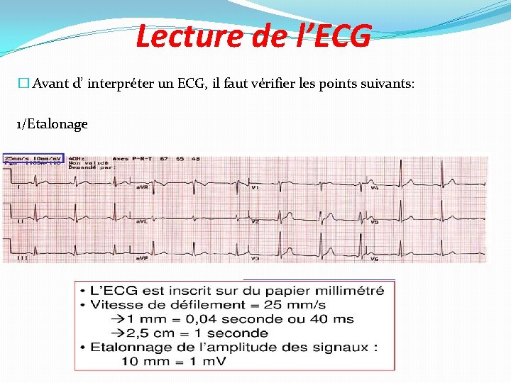 Lecture de l’ECG � Avant d’ interpréter un ECG, il faut vérifier les points