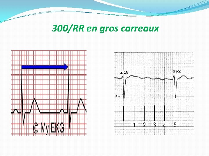 300/RR en gros carreaux 