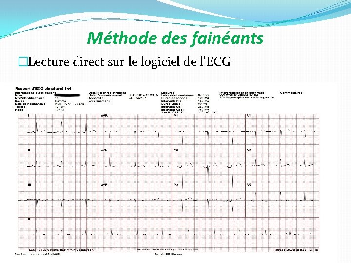 Méthode des fainéants �Lecture direct sur le logiciel de l’ECG 