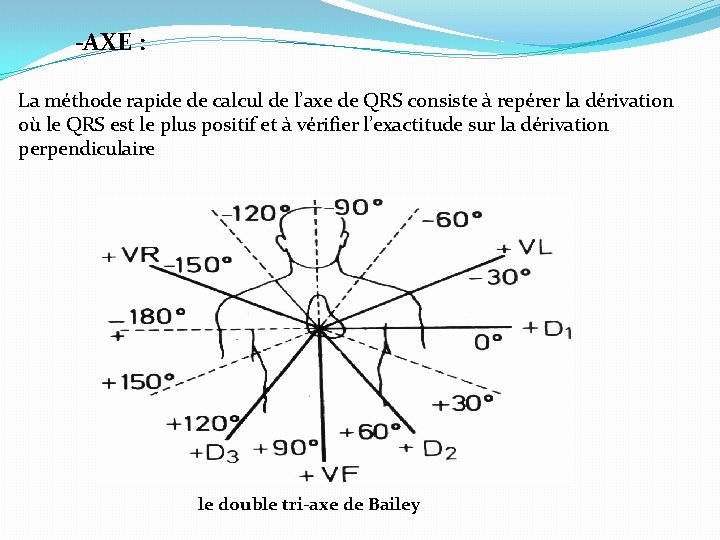 -AXE : La méthode rapide de calcul de l’axe de QRS consiste à repérer