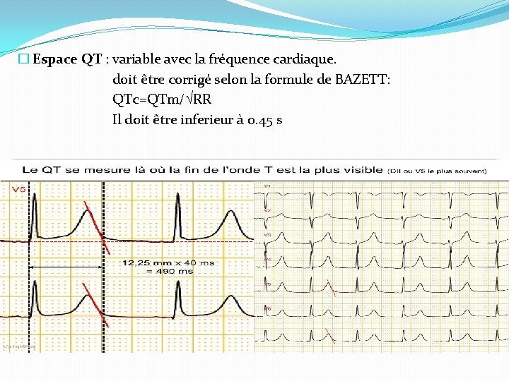 � Espace QT : variable avec la fréquence cardiaque. doit être corrigé selon la