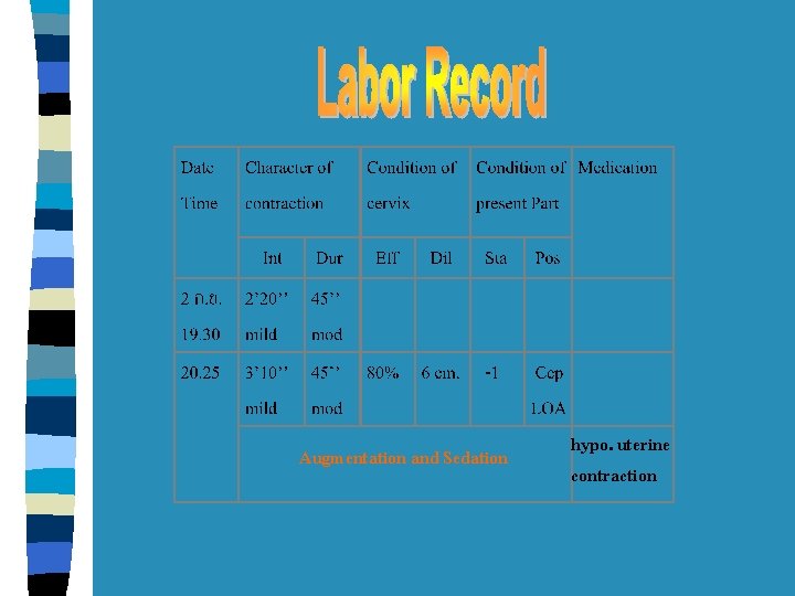 Augmentation and Sedation hypo. uterine contraction 