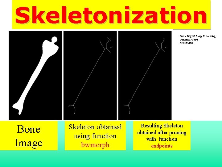 Skeletonization From: Digital Image Processing, Gonzalez, Woods And Eddins Bone Image Skeleton obtained using