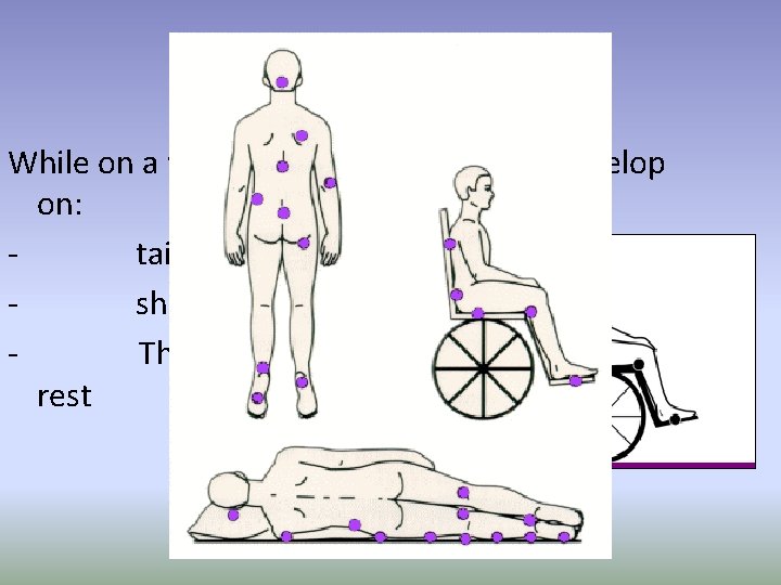 While on a wheelchair a pressure sore develop on: tailbone or buttocks shoulder blades