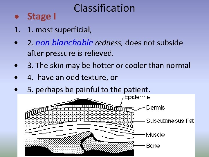  Stage I Classification 1. 1. most superficial, 2. non blanchable redness, does not