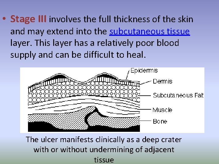  • Stage III involves the full thickness of the skin and may extend