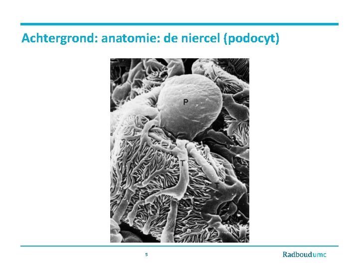 Achtergrond: anatomie: de niercel (podocyt) 5 