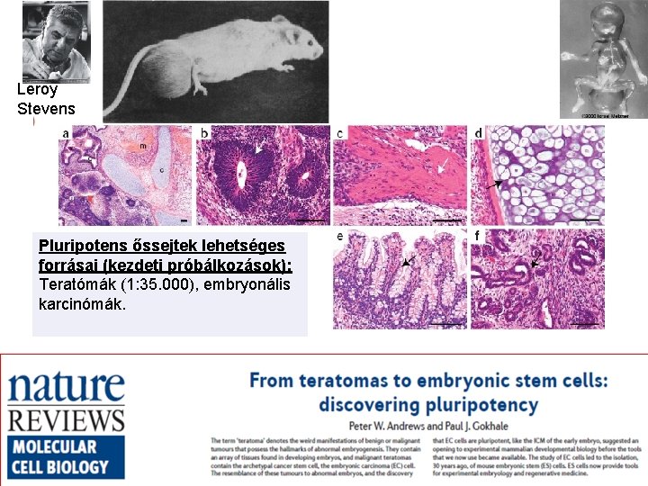 Leroy Stevens Pluripotens őssejtek lehetséges forrásai (kezdeti próbálkozások): Teratómák (1: 35. 000), embryonális karcinómák.