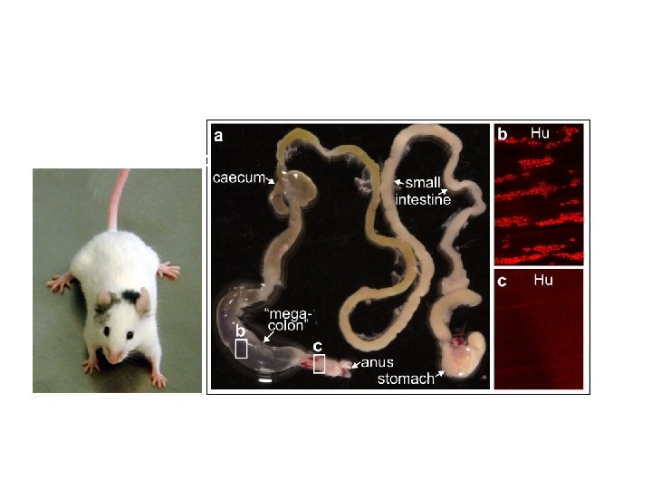 Ednrb-/(Endothelin Receptor B) 