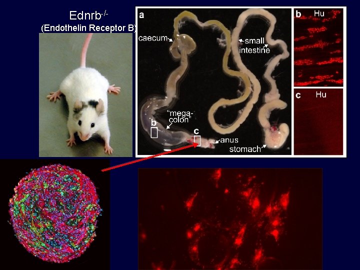 Ednrb-/(Endothelin Receptor B) 