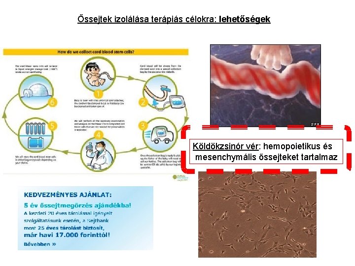 Őssejtek izolálása terápiás célokra: lehetőségek Köldökzsinór vér: hemopoietikus és mesenchymális őssejteket tartalmaz 