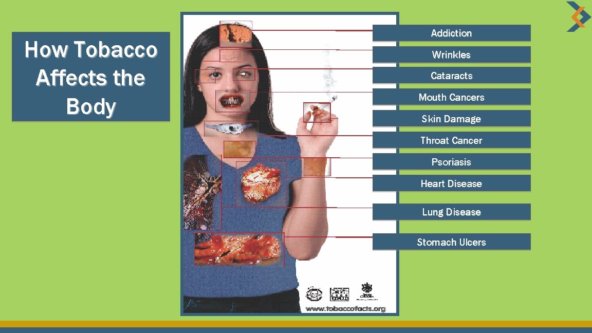 How Tobacco Affects the Body Addiction Wrinkles Cataracts Mouth Cancers Skin Damage Throat Cancer