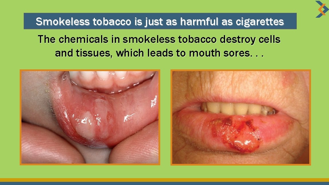 Smokeless tobacco is just as harmful as cigarettes The chemicals in smokeless tobacco destroy