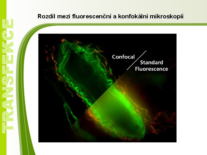 TRANSFEKCE Rozdíl mezi fluorescenční a konfokální mikroskopií 