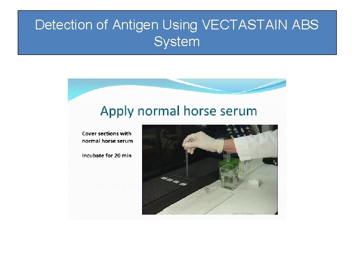 Detection of Antigen Using VECTASTAIN ABS System Detection of Antigen Using VECTASTAIN ABS System