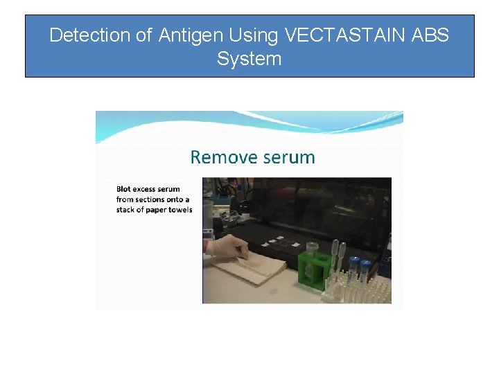Detection of Antigen Using VECTASTAIN ABS System Detection of Antigen Using VECTASTAIN ABS System