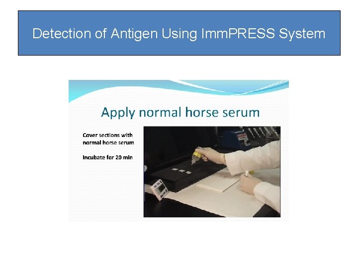 Detection of Antigen Using Imm. PRESS System Detection of Antigen Using Imm. PRESS System