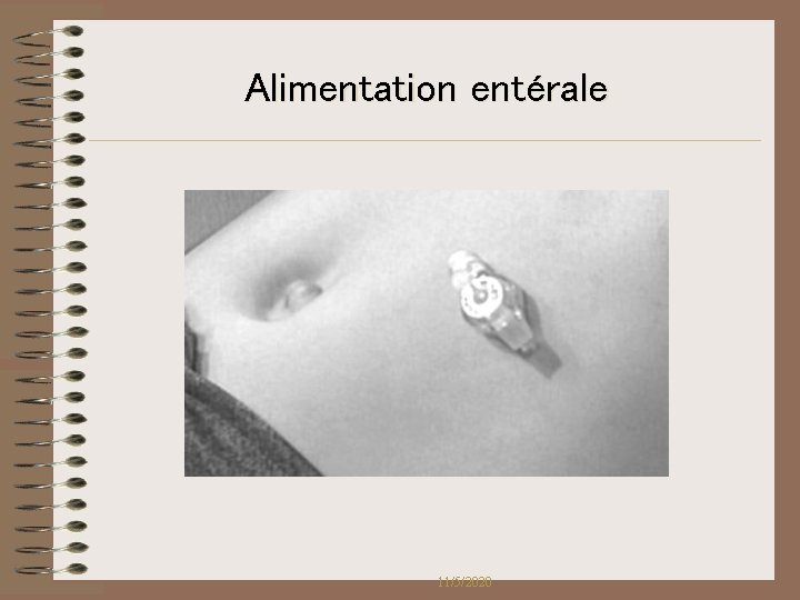 Alimentation entérale 11/5/2020 Alimentation entérale 11/5/2020