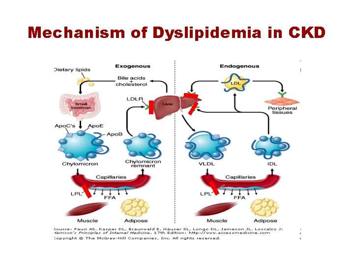 Mechanism of Dyslipidemia in CKD 