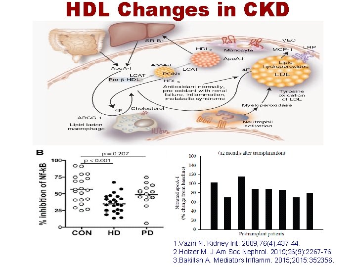 HDL Changes in CKD 1. Vaziri N. Kidney Int. 2009; 76(4): 437 -44. 2.