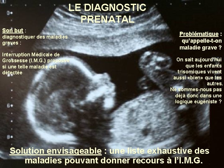 LE DIAGNOSTIC PRENATAL Son but : diagnostiquer des maladies graves : Interruption Médicale de