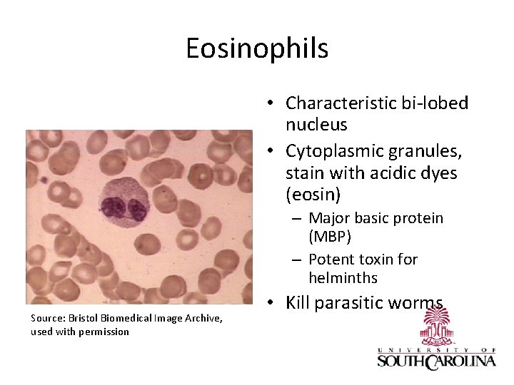 Eosinophils • Characteristic bi-lobed nucleus • Cytoplasmic granules, stain with acidic dyes (eosin) –