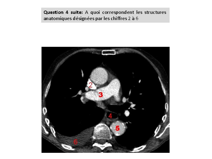 Question 4 suite: A quoi correspondent les structures anatomiques désignées par les chiffres 2