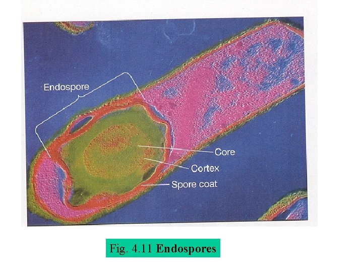 Fig. 4. 11 Endospores 
