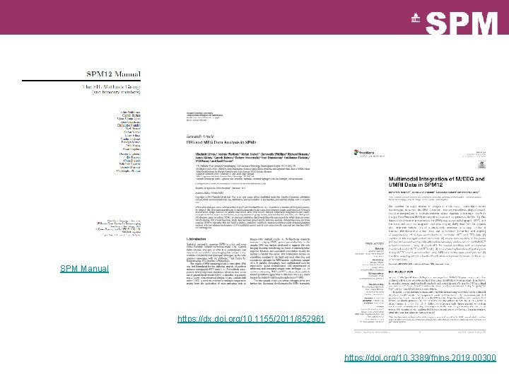 SPM Manual https: //dx. doi. org/10. 1155/2011/852961 https: //doi. org/10. 3389/fnins. 2019. 00300 SPM Manual https: //dx. doi. org/10. 1155/2011/852961 https: //doi. org/10. 3389/fnins. 2019. 00300