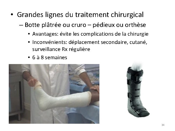  • Grandes lignes du traitement chirurgical – Botte plâtrée ou cruro – pédieux
