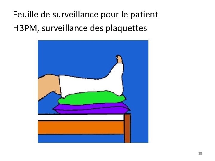 Feuille de surveillance pour le patient HBPM, surveillance des plaquettes 35 