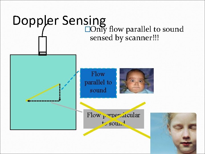 Doppler Sensing �Only flow parallel to sound sensed by scanner!!! Flow parallel to sound