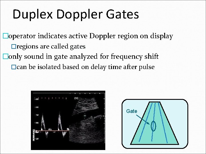 Duplex Doppler Gates �operator indicates active Doppler region on display �regions are called gates