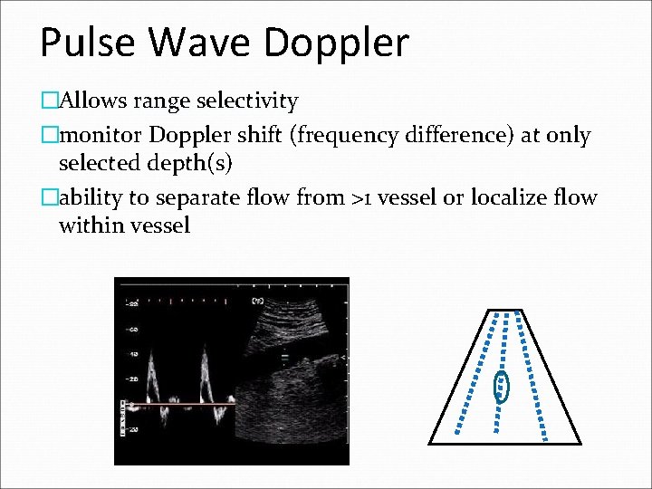 Pulse Wave Doppler �Allows range selectivity �monitor Doppler shift (frequency difference) at only selected