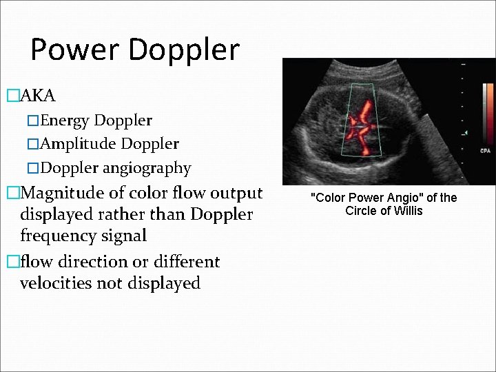 Power Doppler �AKA �Energy Doppler �Amplitude Doppler �Doppler angiography �Magnitude of color flow output