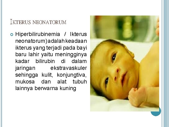 IKTERUS NEONATORUM Hiperbilirubinemia / Ikterus neonatorum) adalah keadaan ikterus yang terjadi pada bayi baru