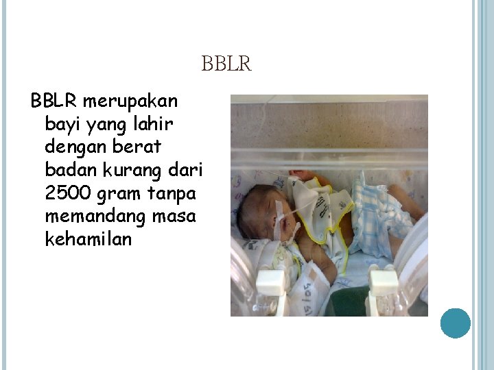 BBLR merupakan bayi yang lahir dengan berat badan kurang dari 2500 gram tanpa memandang