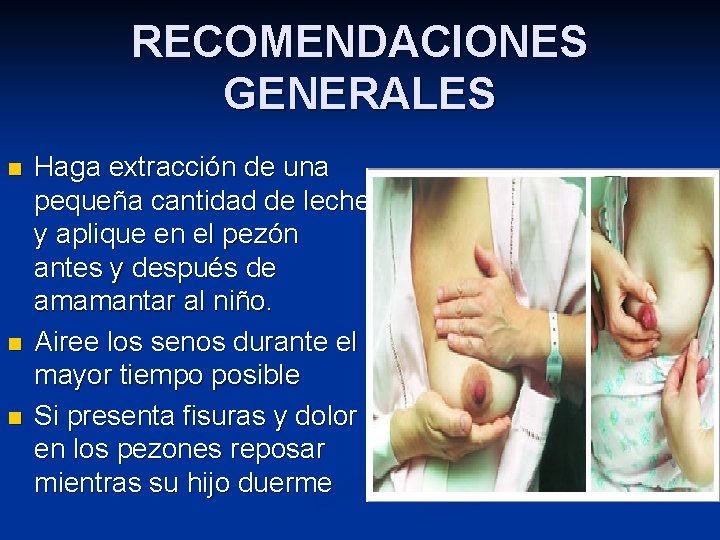 RECOMENDACIONES GENERALES n n n Haga extracción de una pequeña cantidad de leche y