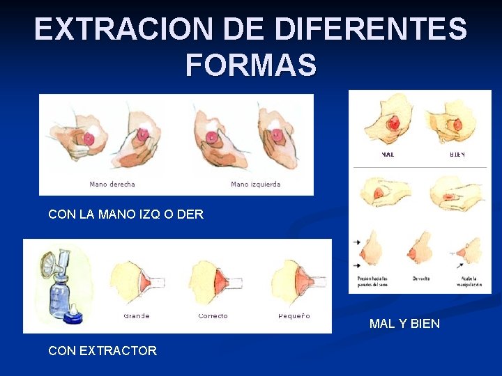 EXTRACION DE DIFERENTES FORMAS CON LA MANO IZQ O DER MAL Y BIEN CON