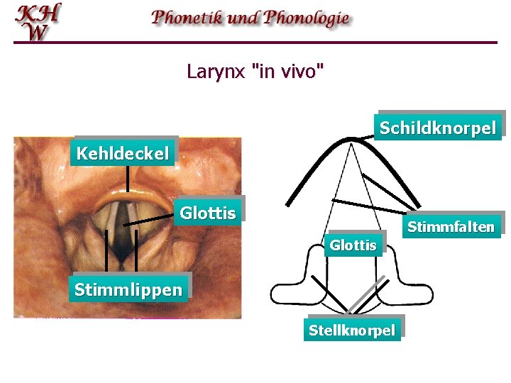 Larynx "in vivo" Schildknorpel Kehldeckel Glottis Stimmfalten Glottis Stimmlippen Stellknorpel 