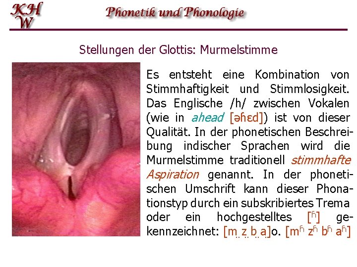 Stellungen der Glottis: Murmelstimme Es entsteht eine Kombination von Stimmhaftigkeit und Stimmlosigkeit. Das Englische