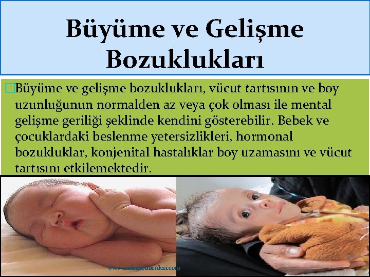 Büyüme ve Gelişme Bozuklukları �Büyüme ve gelişme bozuklukları, vücut tartısının ve boy uzunluğunun normalden