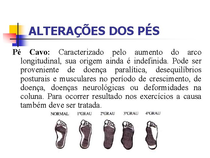 ALTERAÇÕES DOS PÉS Pé Cavo: Caracterizado pelo aumento do arco longitudinal, sua origem ainda